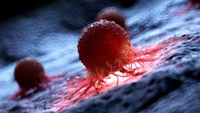 Shkencëtarët zbulojnë mënyrën e re për të shkatërruar 99% të qelizave kancerogjene në një laborator
